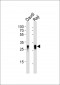 HLA-DRB1 Antibody (Center)